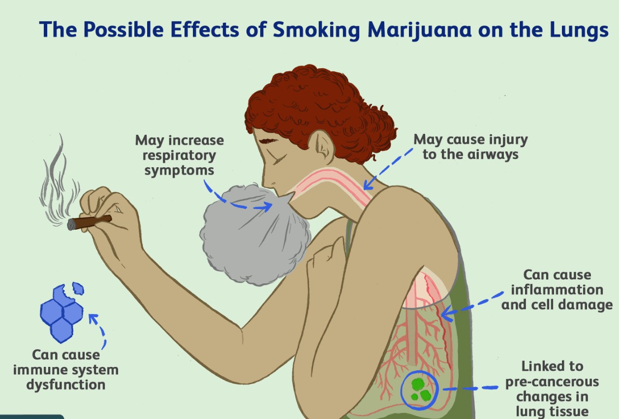 cannabis lung cancer