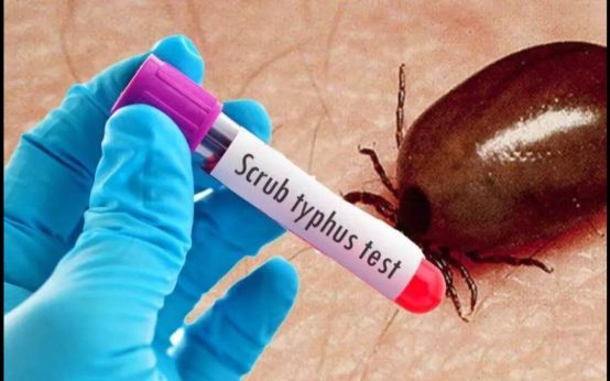 what is scrub typhus telugu